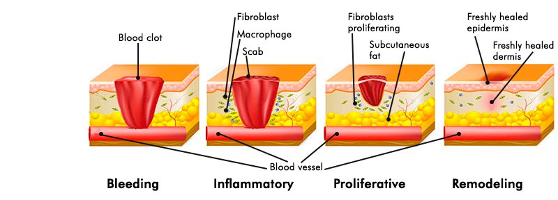 Wound Healing